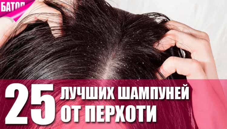 топ шампуней от перхоти топ шампуней от перхоти