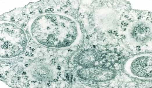 Виды Волбакии (Wolbachia)