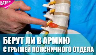 Берут ли в армию с грыжей поясничного отдела