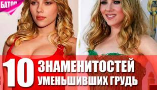 Про знаменитостей, хирургически уменьшивших грудь